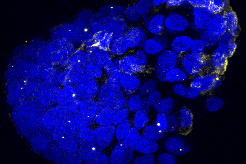 lung model under microscope
